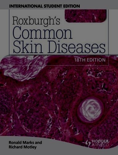 roxburghs common skin diseases 18th edition